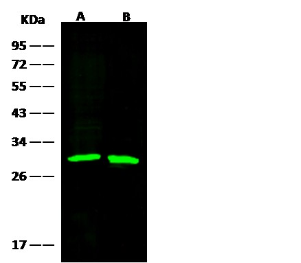Recombinant GSTM2 Monoclonal Antibody - small - 3