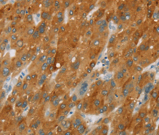 CYP2E1 Polyclonal Antibody - 2