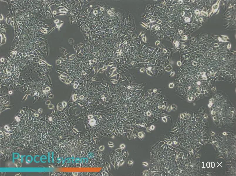 JIMT-1 Cell Complete Medium - 1