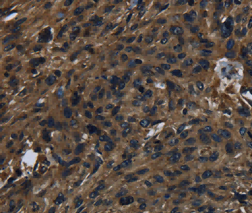 KLK14 Polyclonal Antibody - 2