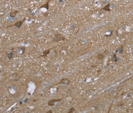 PTK2B Polyclonal Antibody - 2