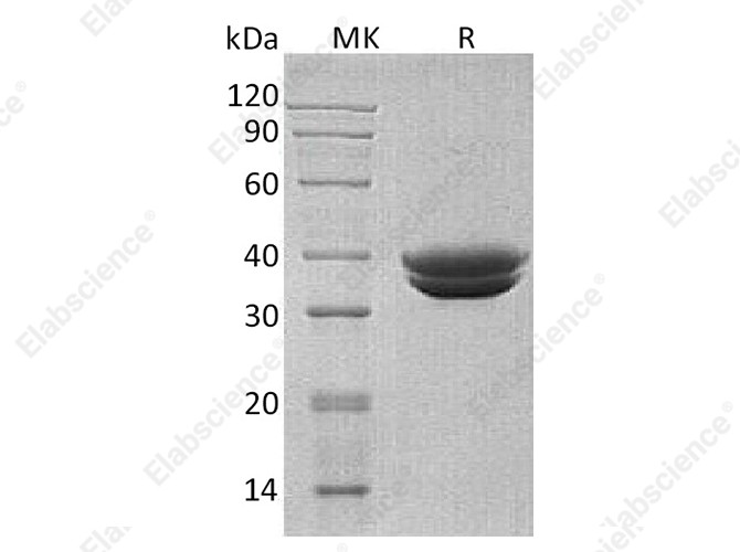 Recombinant Human GPA33 Protein (His Tag) - 1