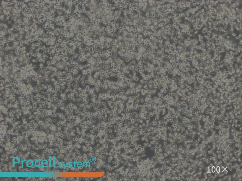 MEC-1 Cell Complete Medium - 1