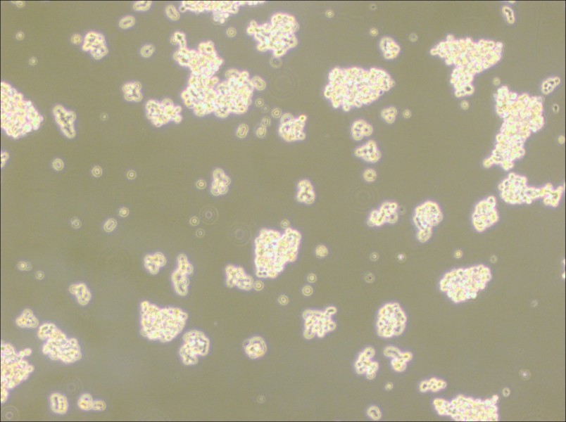 NCI-H146 [H146] Cell Complete Medium - 3