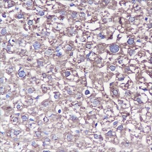 Recombinant ANGPTL3 Monoclonal Antibody - 3