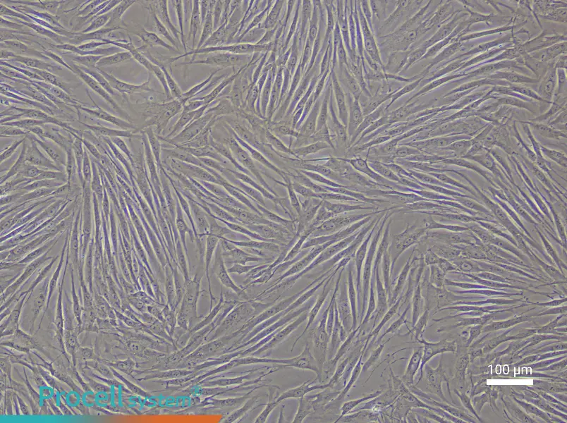 Human Umbilical Vein Smooth Muscle Cell Complete Medium - 3