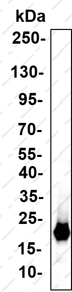 Recombinant Myoglobin Monoclonal Antibody - 2