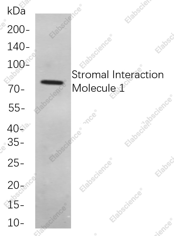 Recombinant Stromal Interaction Molecule 1 Monoclonal Antibody - 1