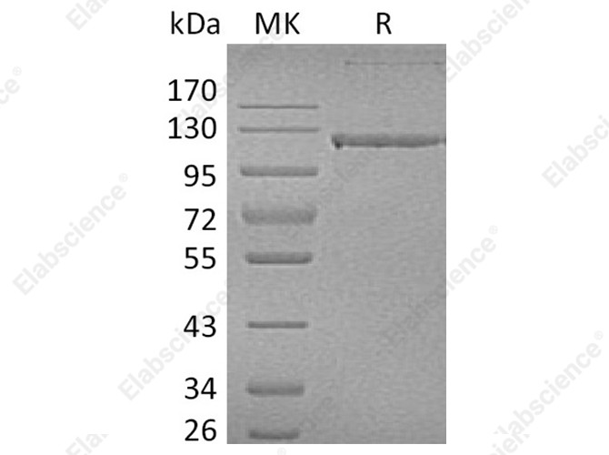 Recombinant Human CD31/PECAM1 Protein (Fc Tag) - 1
