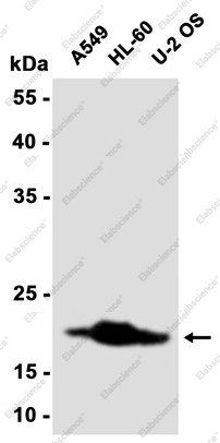 Recombinant UBE2C Monoclonal Antibody - 3