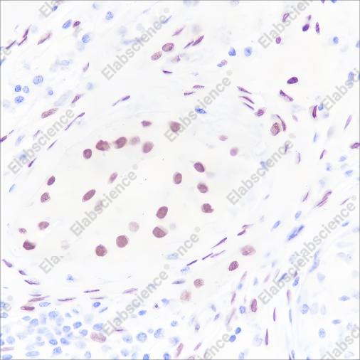 Recombinant Androgen Receptor (CT) Monoclonal Antibody - 3