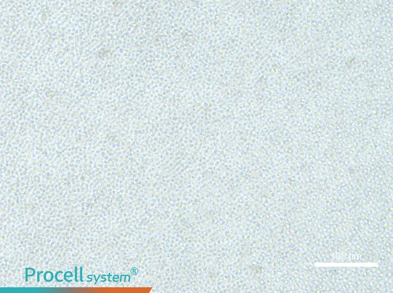 OCI-AML-2OCI-AML-2 - 3
