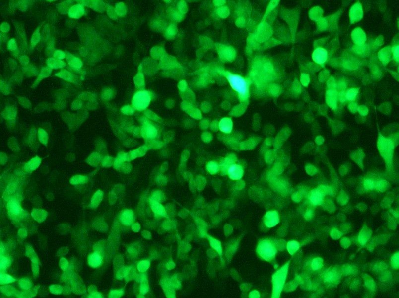 RM-1-GFP Cell Complete Medium - small - 5