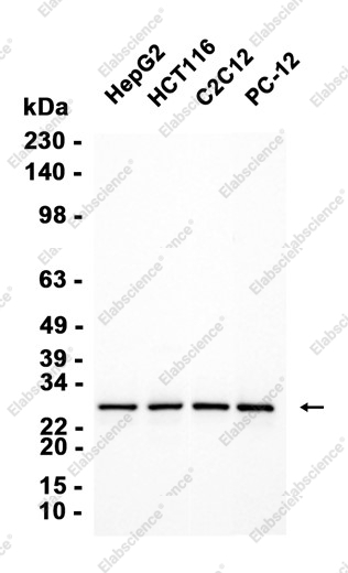 Recombinant RPS8 Monoclonal Antibody - 1