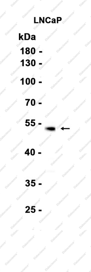 Recombinant SLC45A3 Monoclonal Antibody - 1