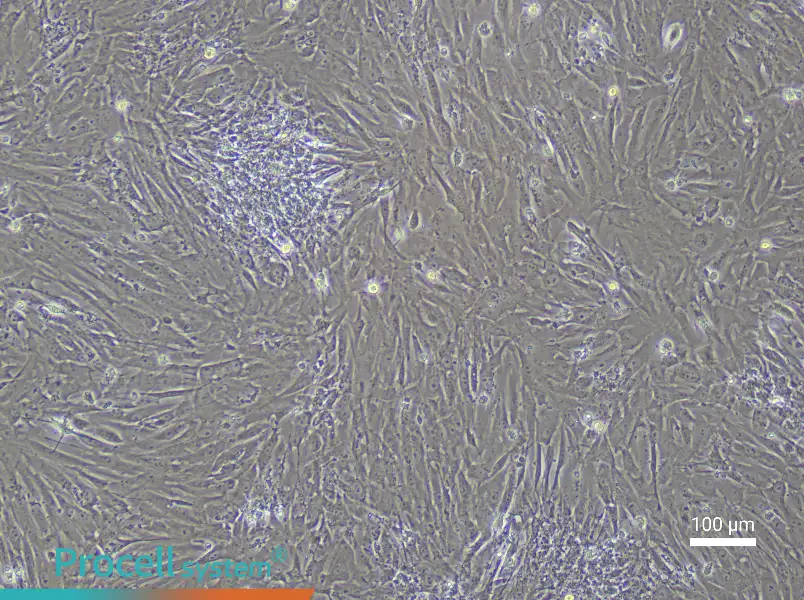 Mouse Uterine Fibroblast Complete Medium - 3