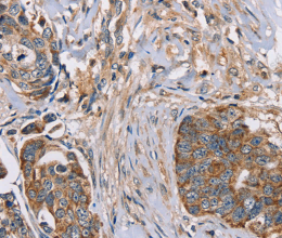 FAIM2 Polyclonal Antibody - 3