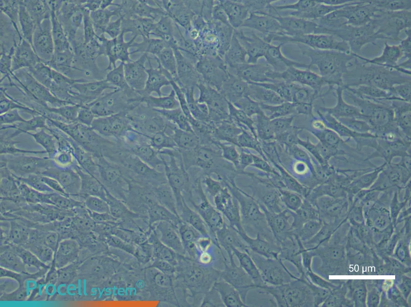 Human Chondrocyte (Primary cell immortalization) Complete Medium - 5