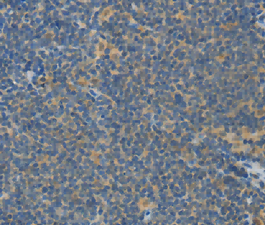 ASPA Polyclonal Antibody - 3