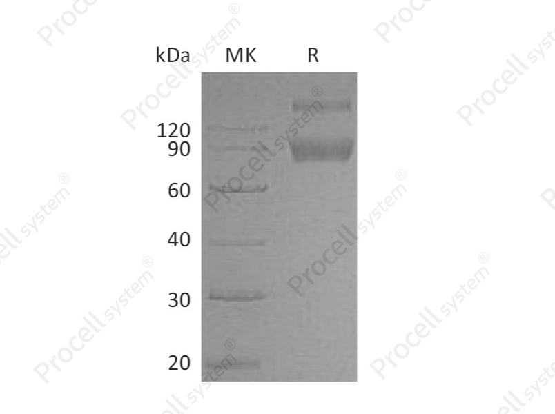 IL-1R-2/CD121b (C-Fc), Mouse, Recombinant