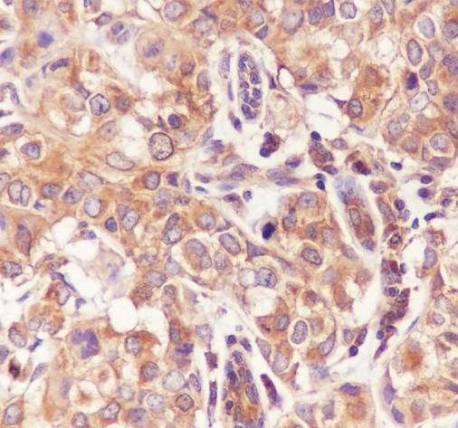 Recombinant TNF receptor II Monoclonal Antibody-searchlist-2