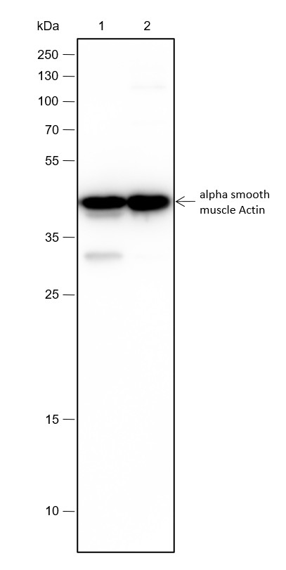 Recombinant alpha smooth muscle Actin Monoclonal Antibody - 2