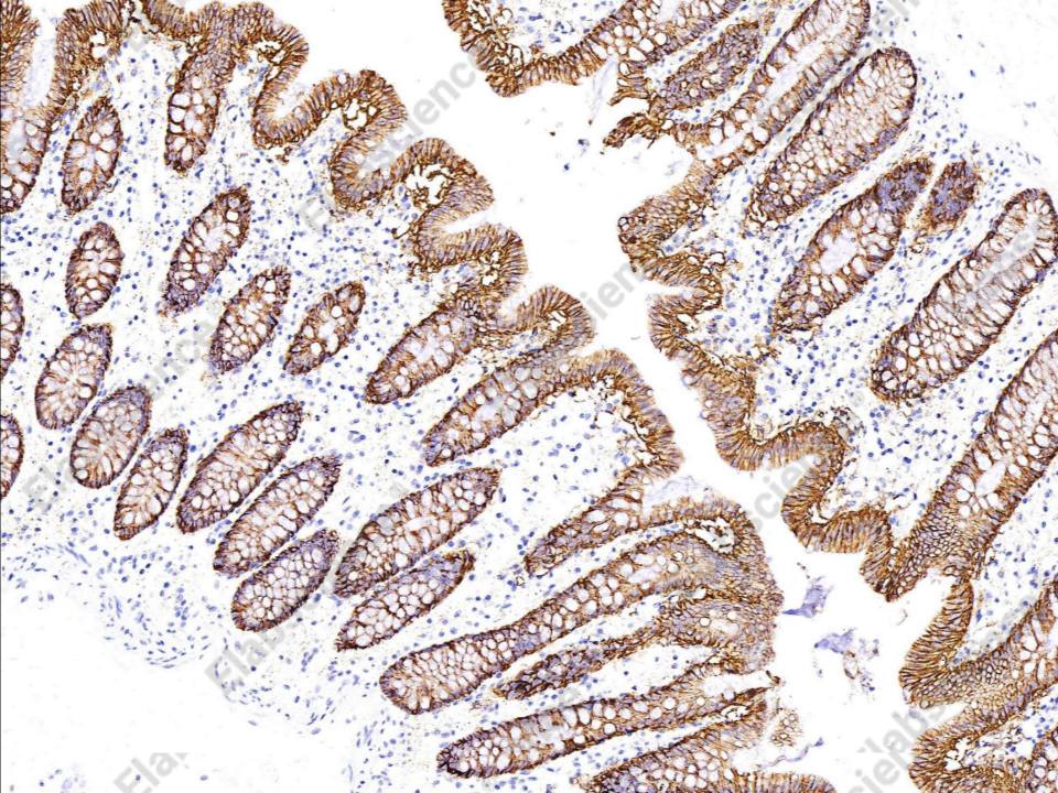Recombinant GPA33 Monoclonal Antibody - 1