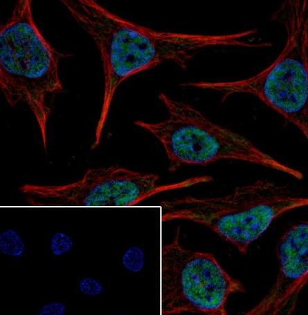 Recombinant RBX1 Monoclonal Antibody - small - 5
