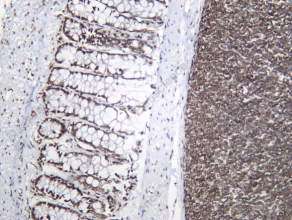 Recombinant HOXB13 Monoclonal Antibody - 2