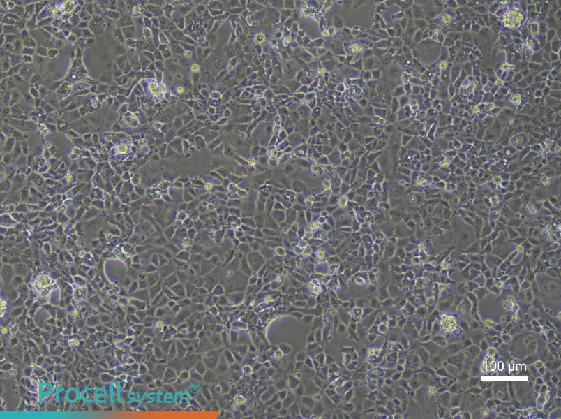 Rat Coronary Artery Endothelial Cells - 1