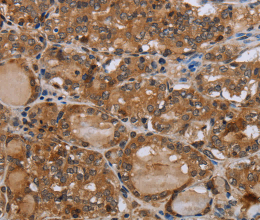MT-ND1 Polyclonal Antibody - 2