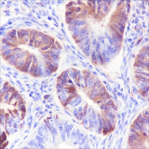 Recombinant Serum Amyloid P/SAP Monoclonal Antibody - small - 2