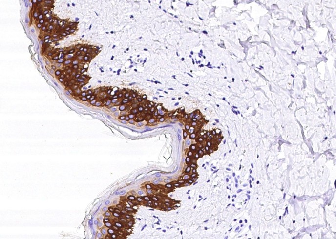 Recombinant KRT14/Cytokeratin 14 Monoclonal Antibody-searchlist-1