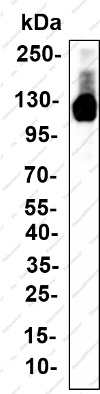 Recombinant HDAC5 (Phospho Ser498) Monoclonal Antibody - 1