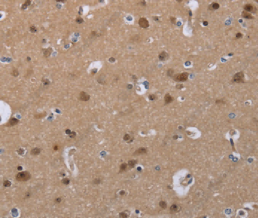 CDK5 Polyclonal Antibody - 3