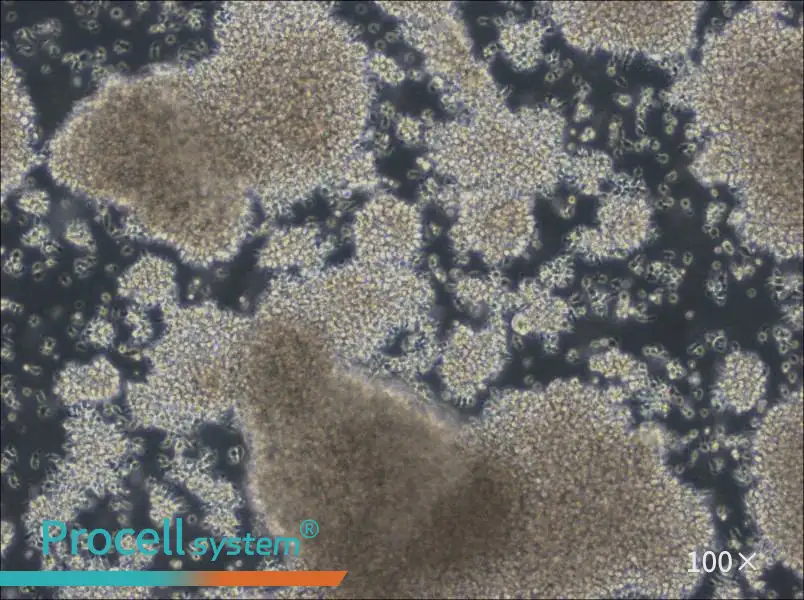 NCI-BL2009 Cell Complete Medium - 3