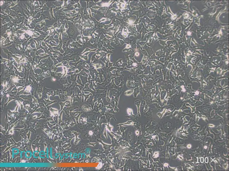 HCC1954 Cell Complete MediumHCC1954 Cell Complete Medium - 3