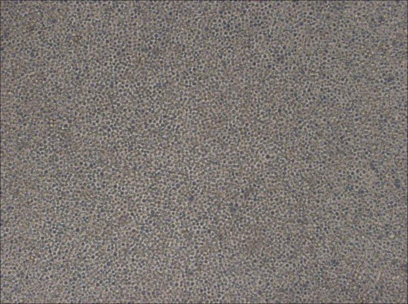 MOLM-13 Cell Complete Medium - 2