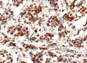 Histone H3 Monoclonal Antibody-searchlist-1