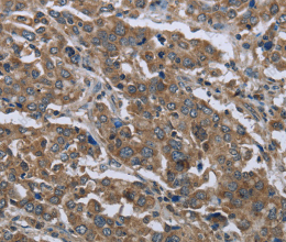 GGCX Polyclonal Antibody - 2