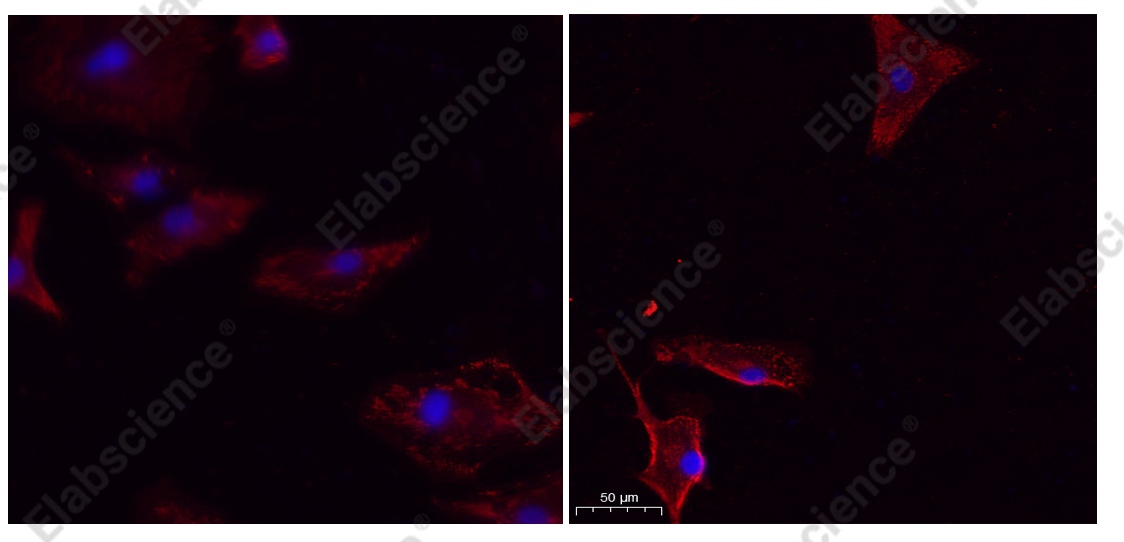 Recombinant Cleaved N-terminal GSDMD Monoclonal Antibody - 3