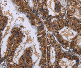LTA4H Polyclonal Antibody - 2