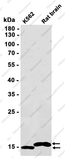 Recombinant NDUFB4 Monoclonal Antibody - 1
