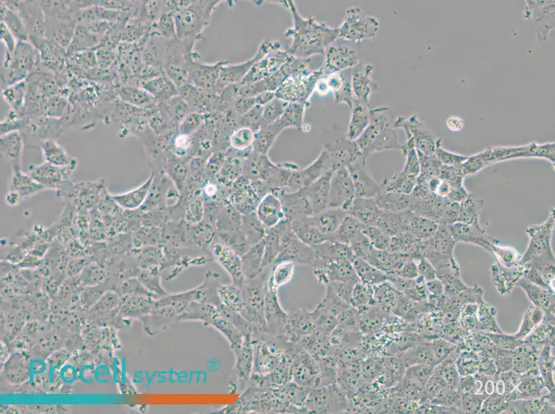 HBL-100 Cell Complete Medium - 4