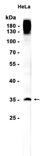Recombinant Syndecan-1/SDC1 Monoclonal Antibody - 1