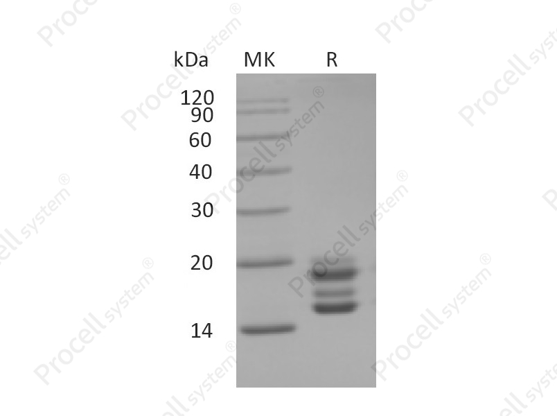 IL-17A/CTLA8 (C-6His), Human, Recombinant