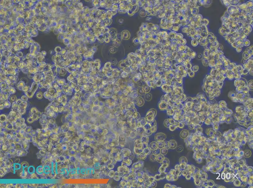 HuT 78 Cell Complete Medium - small - 6