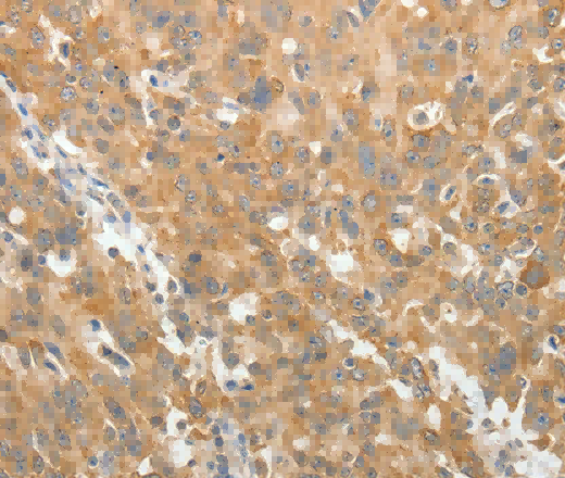 AKR1B1 Polyclonal Antibody - 3