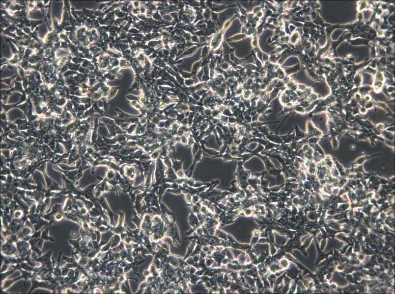 GP2d Cell Complete Medium - 5