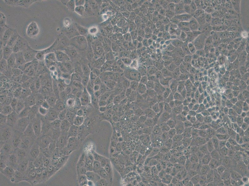 MKN74 Cell Complete Medium - 5